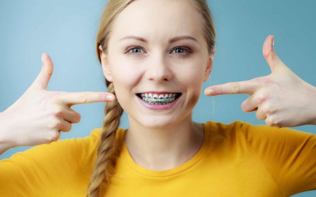How Do Braces Effectively Straighten Teeth?