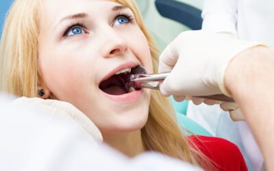 5 Reasons Why A Tooth Extraction Is Needed