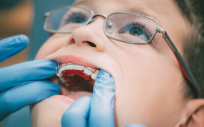 How Early Can a Child See an Orthodontist?